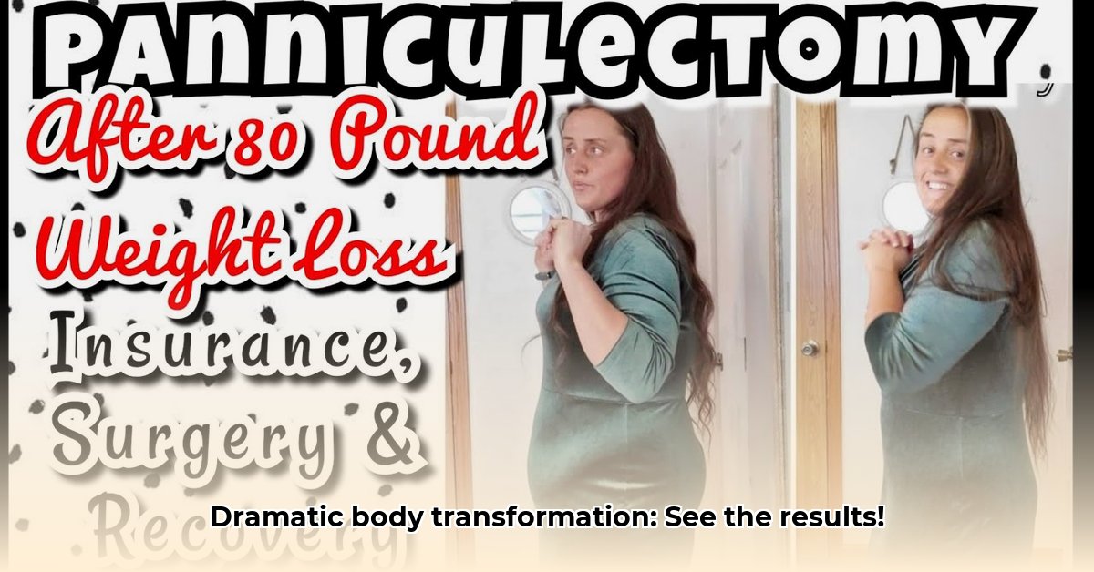 panniculectomy-before-and-after-weight-loss